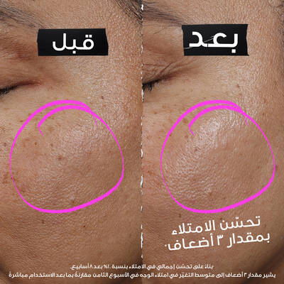 Close-up of model’s cheek with pink serum dots showing application placement, alongside an expert figure in a white coat gesturing toward the skincare tutorial.​