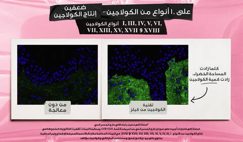 2X Collagen Production on 10 Types