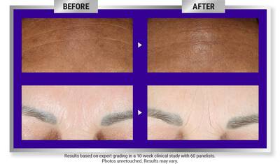 Before and after