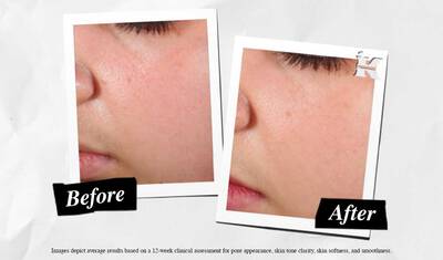 Before and After Super Multi-Corrective Soft Cream