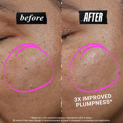 Close-up of model’s cheek with pink serum dots showing application placement, alongside an expert figure in a white coat gesturing toward the skincare tutorial.​