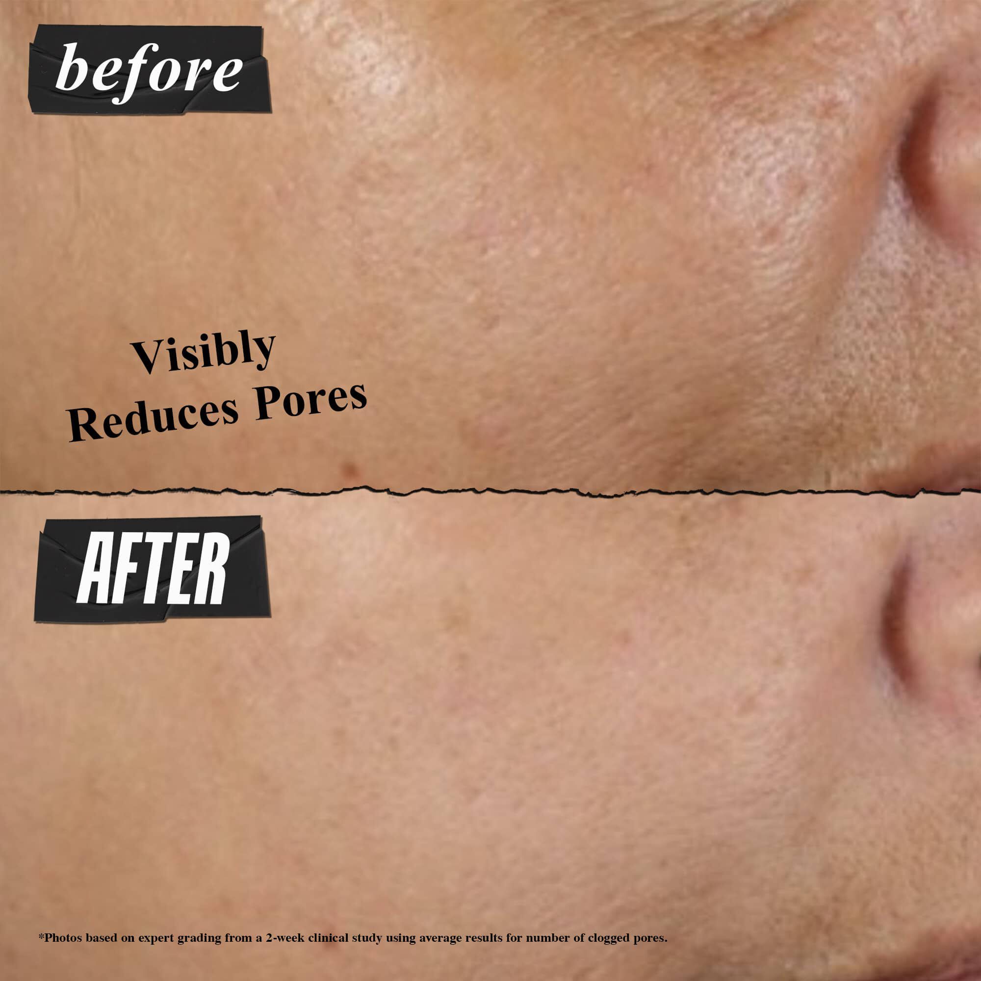 ماسك رير إيرث للتنظيف العميق للمسام