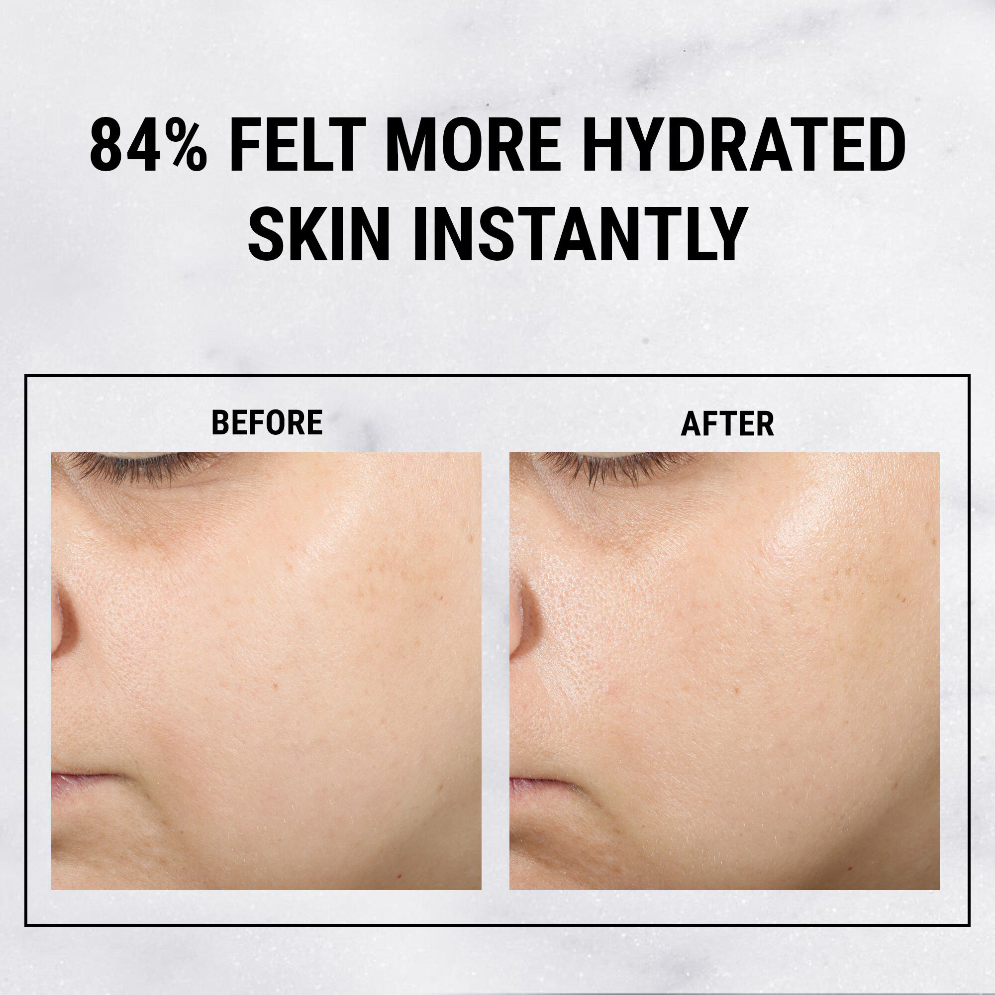 ألترا بيور هاي-بوتنسي ١.٥٪ حمض الهيالورونيك